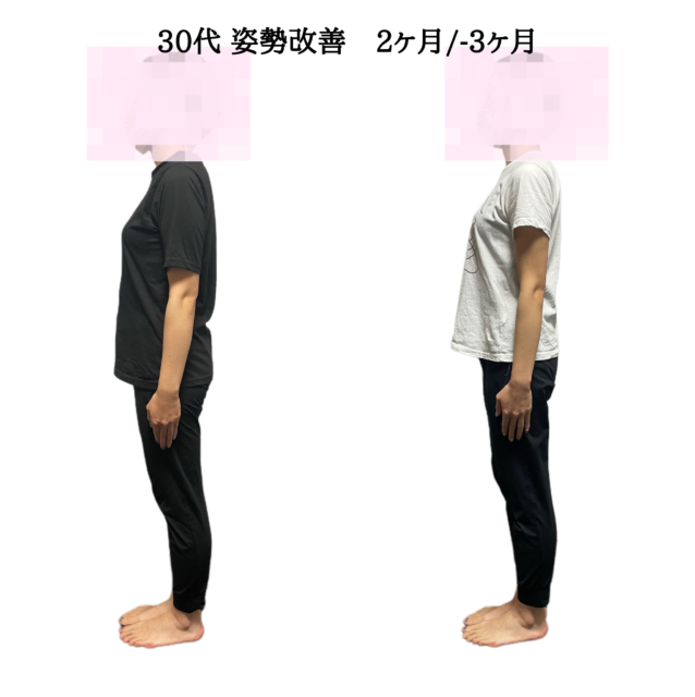 30代 姿勢改善 2ヶ月-3ヶ月