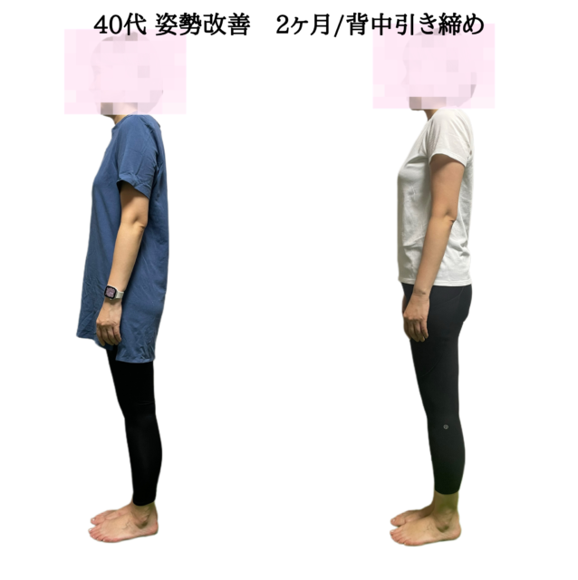 40代 姿勢改善 2ヶ月背中引き締め